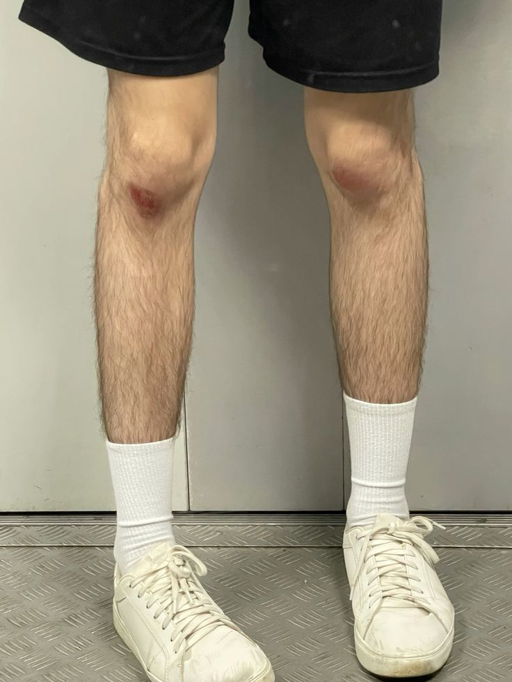 Nam có nên wax lông không