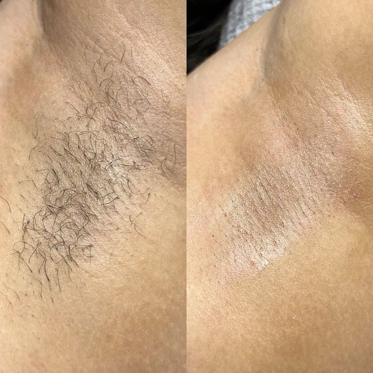 Sự thật đằng sau sáp wax Netta