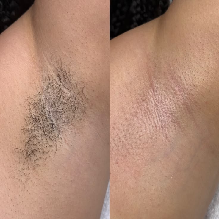 Độ dài lông lý tưởng khi wax