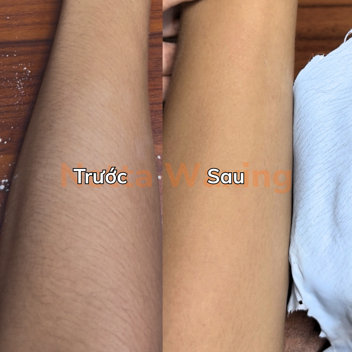 Trước và sau khi wax tay bằng sáp dừa