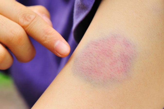 wax lông lần đầu gây chảy máu