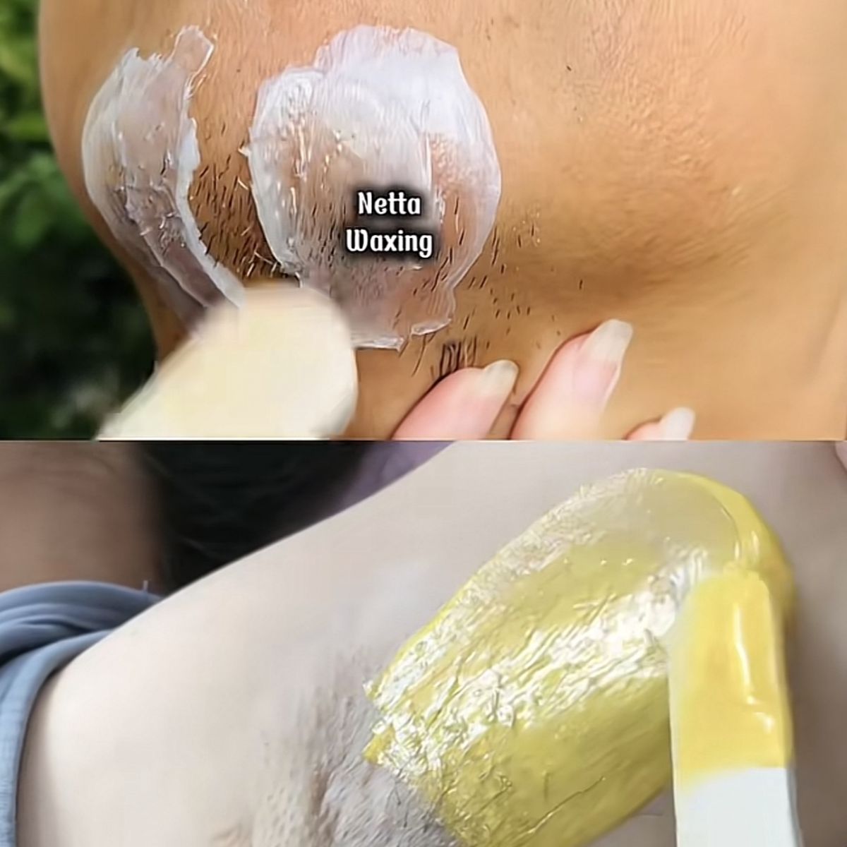 Wax các vùng lông cứng như nách, râu, bikini