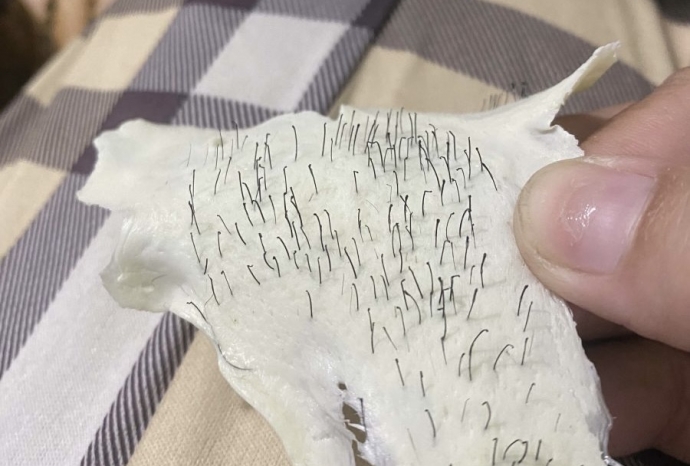 Tại Sao Wax Lông Bị Đứt Ngang, Gãy Sáp? Nguyên Nhân Và Cách Xử Lý